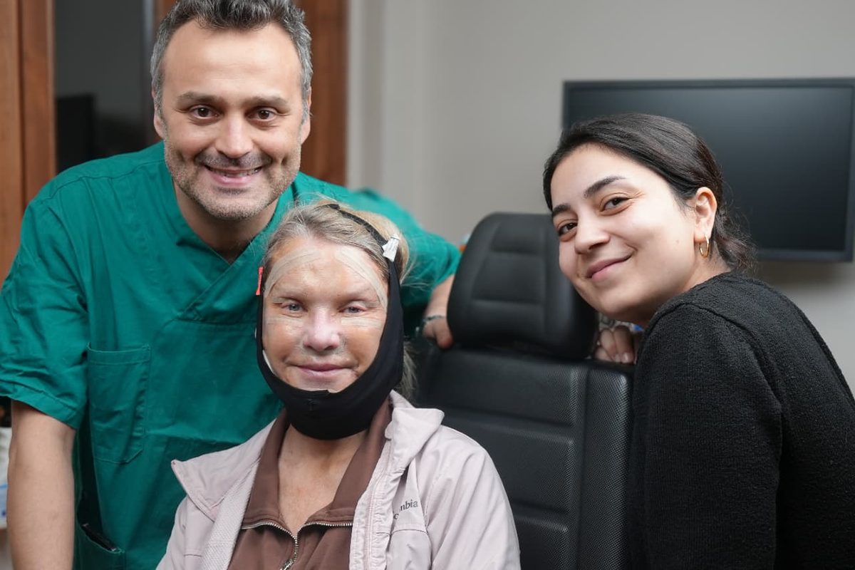Facelift patient in a facial compression garment with her surgeon and nurse at a follow-up in Istanbul