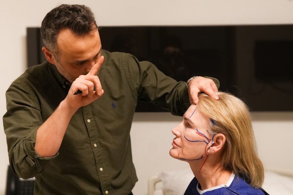 Surgeon marking the deep plane facelift plan on a patient's face before surgery in Istanbul